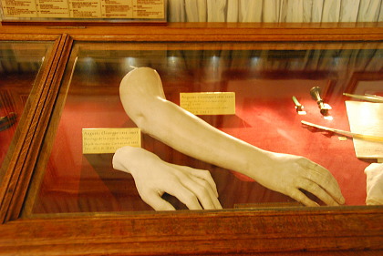 ショパンの手の石膏・パリ市立ロマン主義博物館